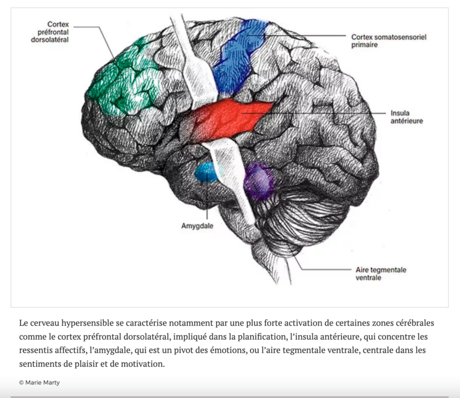 Cerveau des hypesensibles